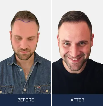 Real Results From Real Patients​ with before and after in dublin