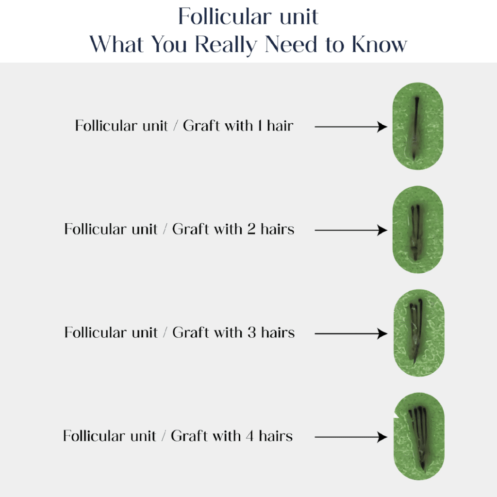 Follicular unit, what you really need to know