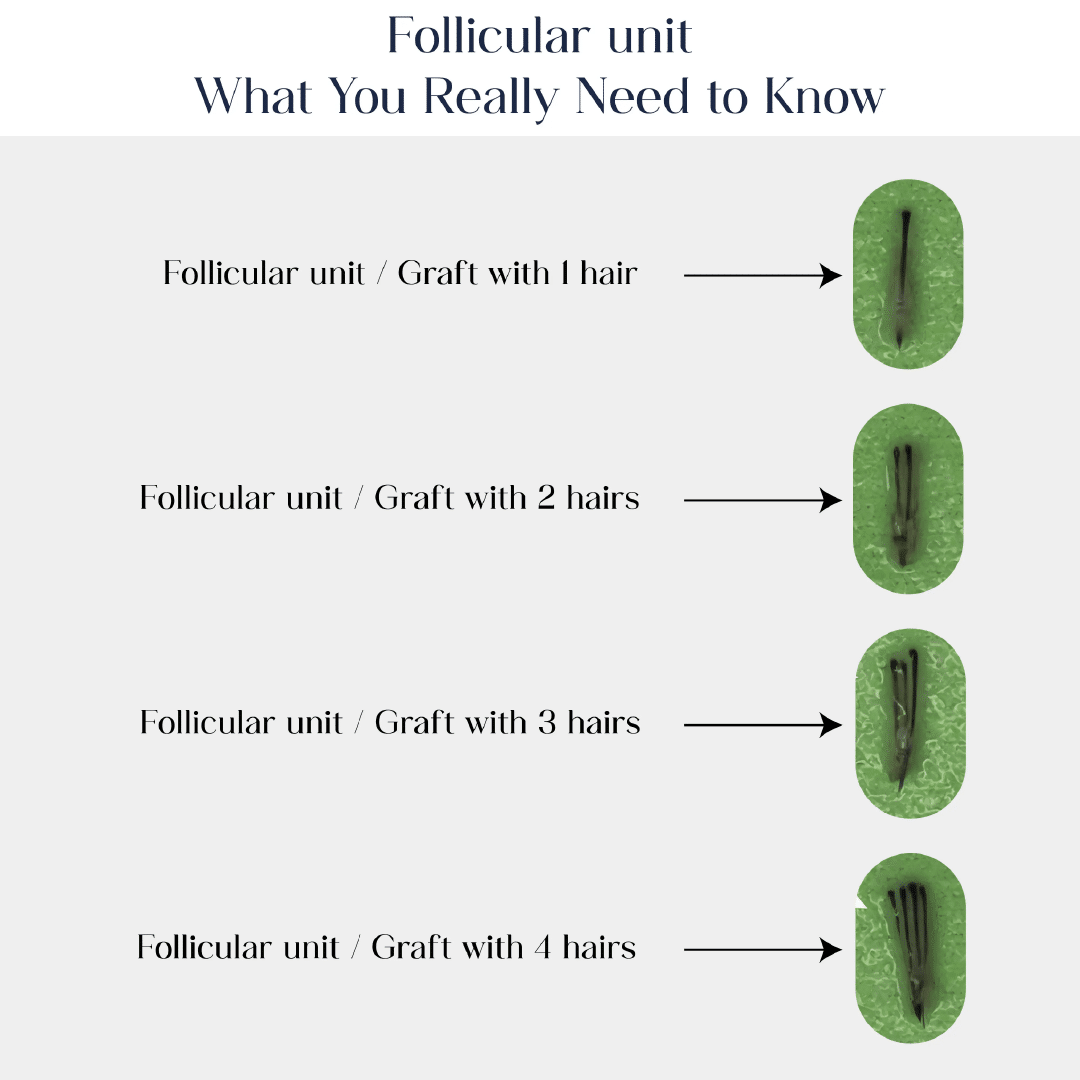Follicular unit, what you really need to know